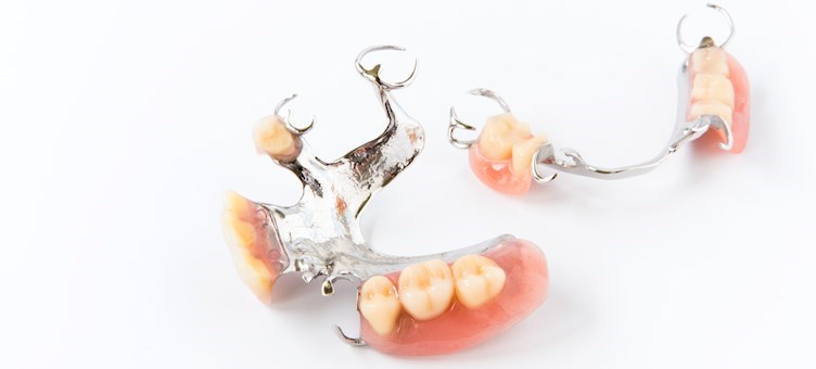 Removable prosthodontics on partial dentures and complete dentures
